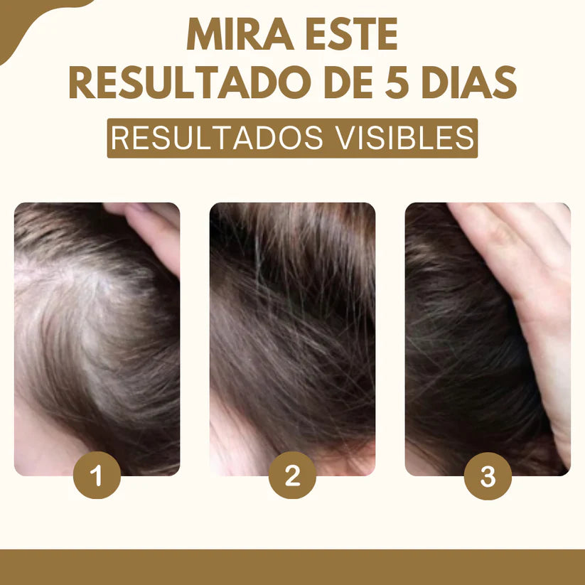 HairBloom™-Di adiós a la caída del pelo en pocos días.