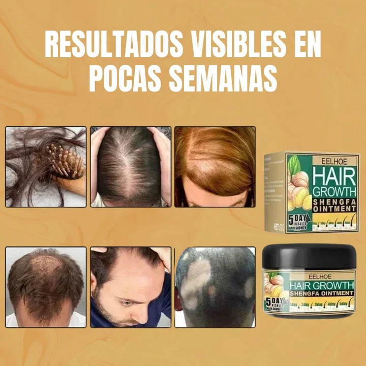 HairBloom™-Di adiós a la caída del pelo en pocos días.